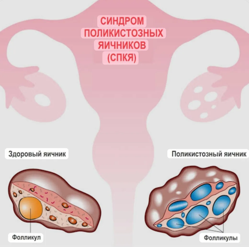 СПКЯ #2