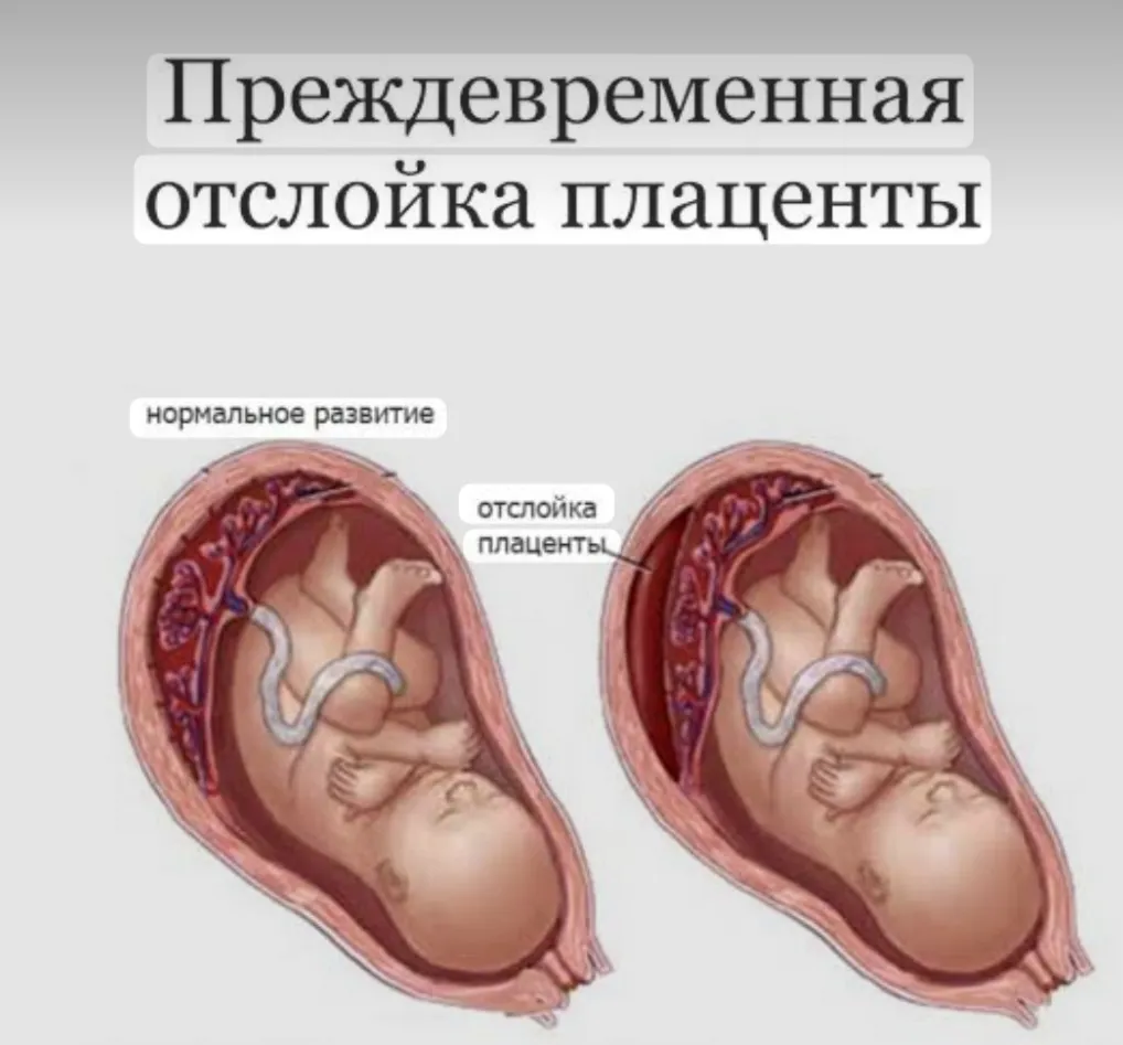 ПОНРП #2