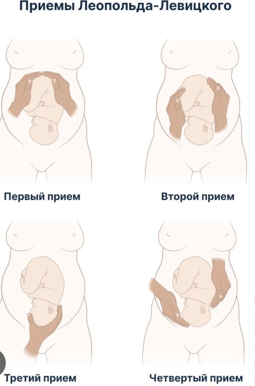 А вы знаете, как мы определяем положение плода, просто осматривая и ощупывая живот беременной? #2