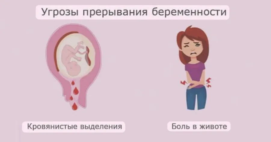 Привычное невынашивание беременности: когда надежда остаётся #1