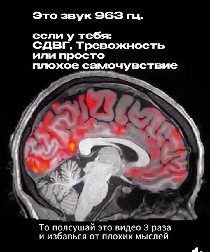 963 Гц #2