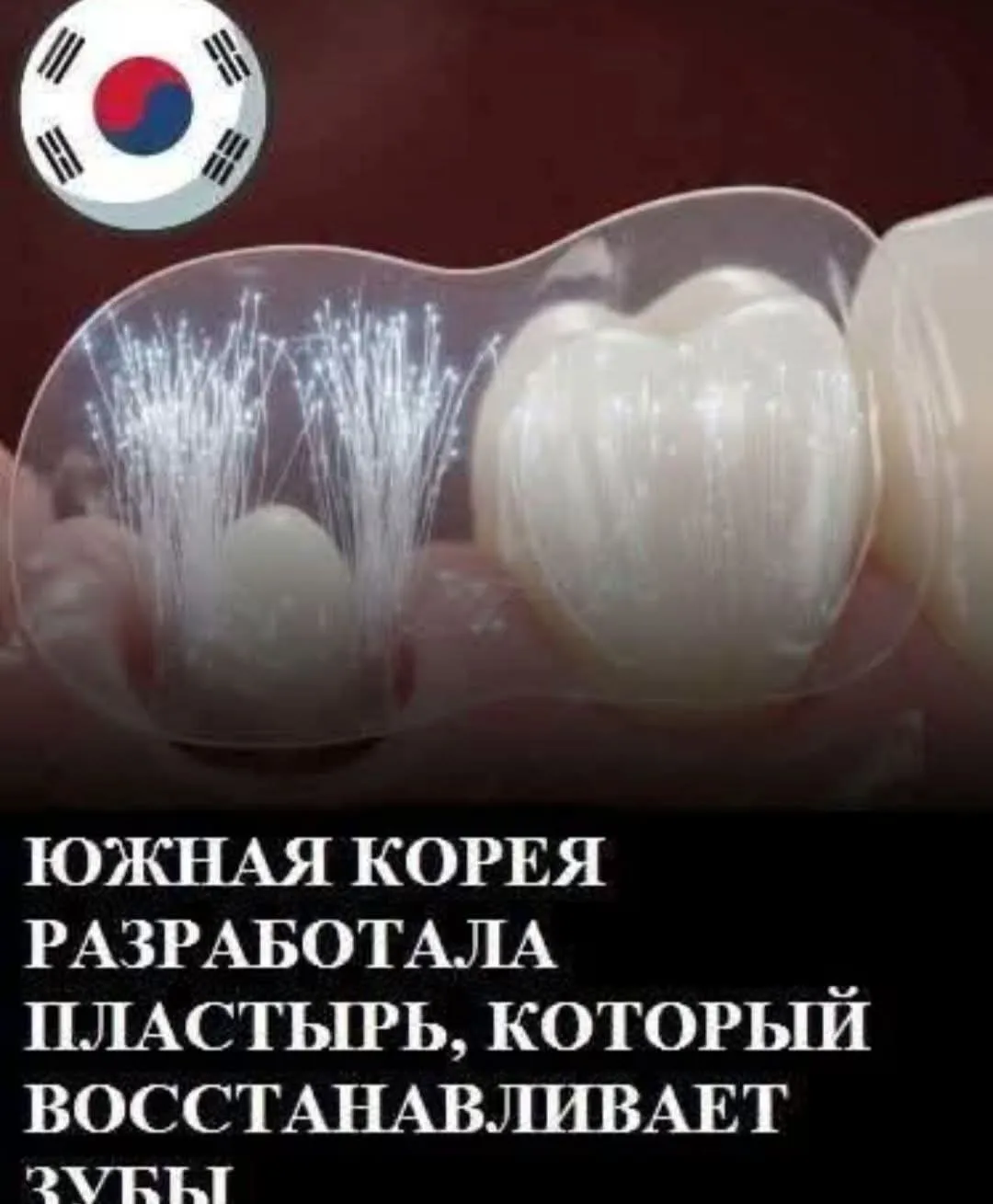 Прорывной микропластырь восстанавливает зубы без протезов и имплантов #2