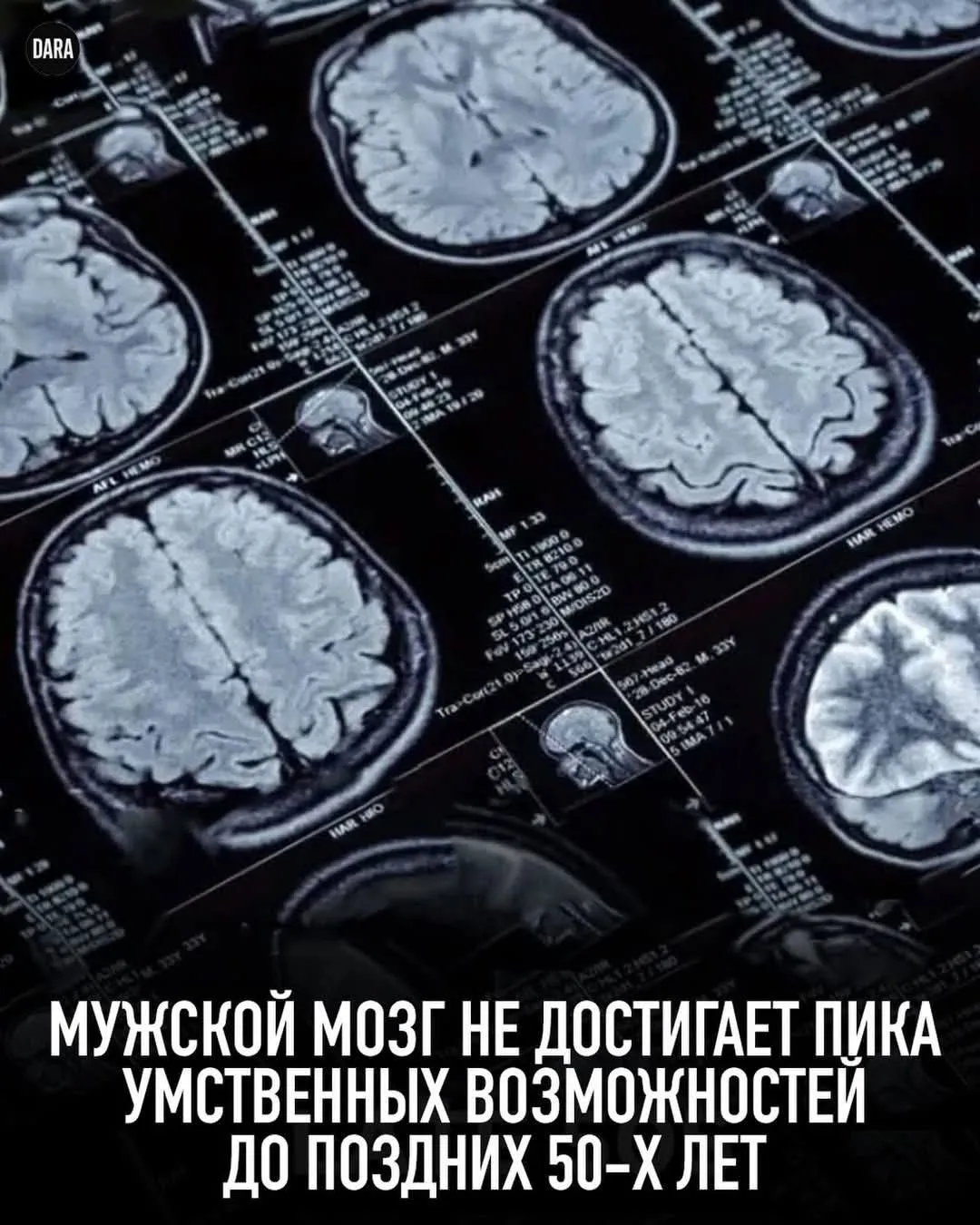А как у вас с когнитивными способностями?  #2