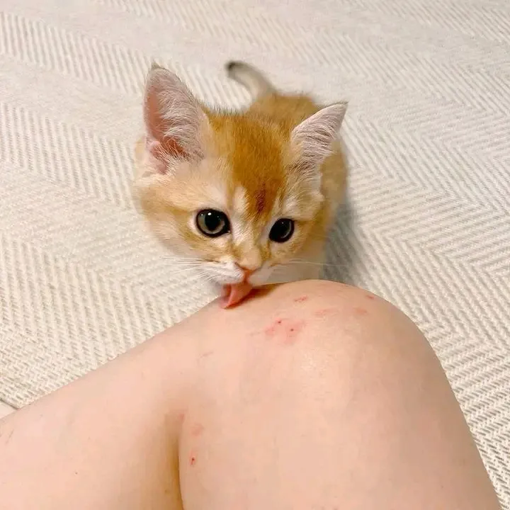Сам поцарапал, сам лечит. Короче. Всё сам🤣🤣🤣